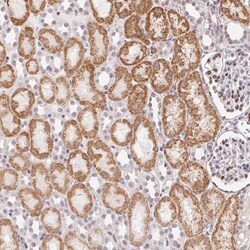 CASC10 Antibody, Novus Biologicals 0.1mL; Unlabeled:Antibodies, Polyclonal